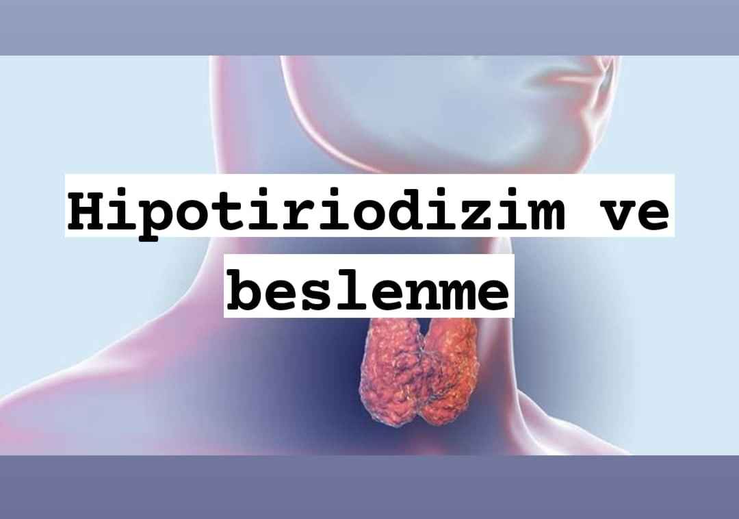 Hipotiriodizim 